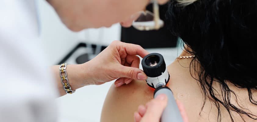 Skin Checks, Skin Cancer Clinic and Skin Cancer Surgery Papamoa